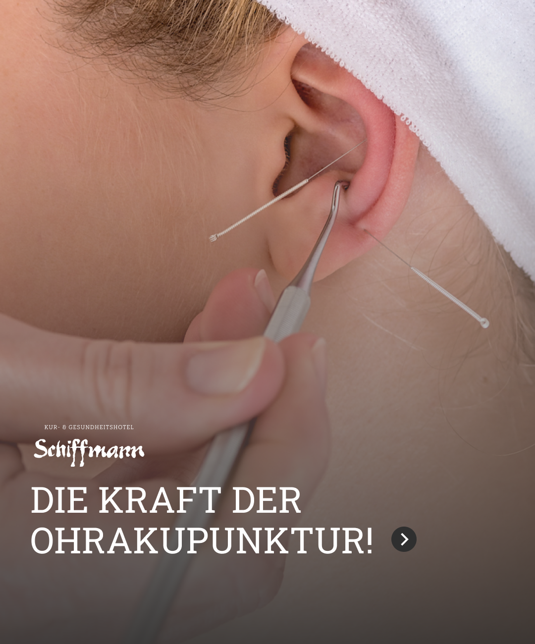 Beitragsgrafik: Ohrakupunktur